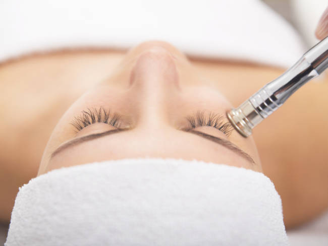 Microdermabrasion, was passiert?
